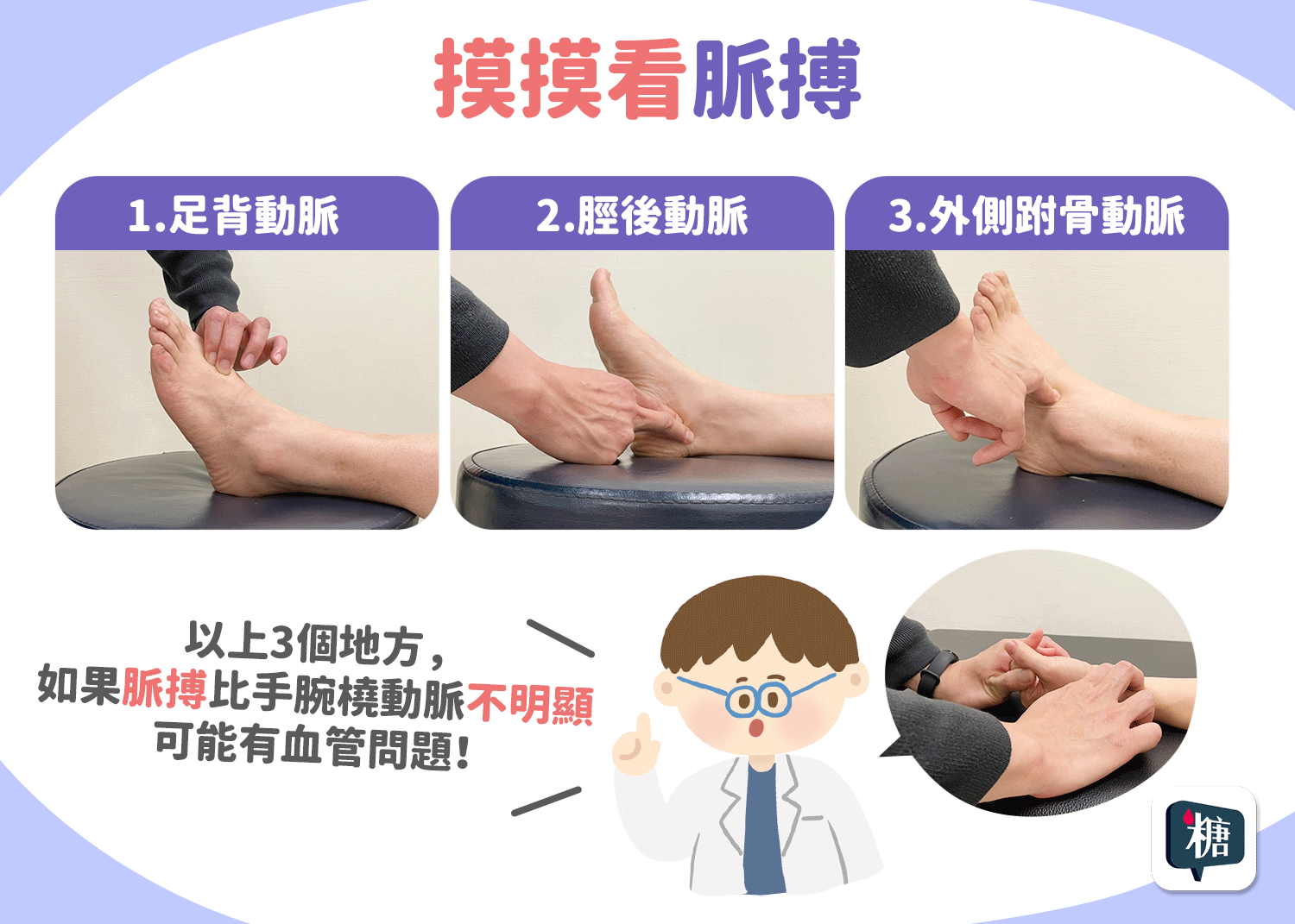 糖尿病人有周邊動脈疾病嗎？摸摸看脈搏